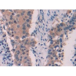 Myosin Light Chain 6, Alkali, Smooth Muscle And Non Muscle (MYL6) Antibody