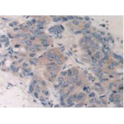 Cytochrome P450 26A1 (CYP26A1) Antibody