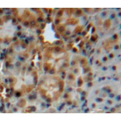 Cytochrome P450 24A1 (CYP24A1) Antibody