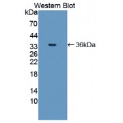 Western blot analysis of recombinant Human SHC1.