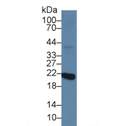 Western blot analysis of Mouse Eye lysate, using Human RCVRN Antibody (2 µg/ml) and HRP-conjugated Goat Anti-Rabbit antibody (<a href="https://www.abbexa.com/index.php?route=product/search&amp;search=abx400043" target="_blank">abx400043</a>, 0.2 µg/ml).
