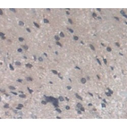 Recoverin (RCVRN) Antibody
