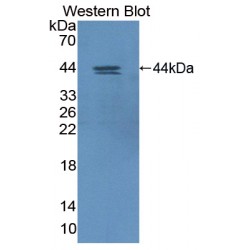 Hypoxia Inducible Factor 1 Alpha Subunit Inhibitor (HIF1aN) Antibody