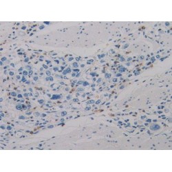 Hypoxia Inducible Factor 1 Alpha Subunit Inhibitor (HIF1aN) Antibody