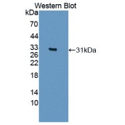 Western blot analysis of recombinant Human CELSR3 protein.