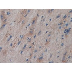 Phosphatidylinositol-Glycan-Specific Phospholipase D (GPLD1) Antibody