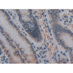 Phosphatidylinositol-Glycan-Specific Phospholipase D (GPLD1) Antibody