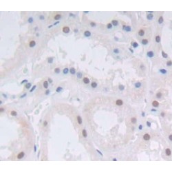 Achaete-Scute Homolog 1 (ASCL1) Antibody