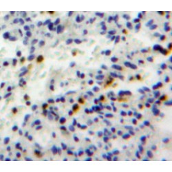 Granzyme H (GZMH) Antibody