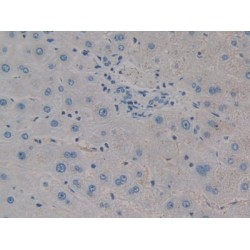 Collagen Triple Helix Repeat Containing Protein 1 (CTHRC1) Antibody