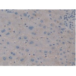 Collagen Triple Helix Repeat Containing Protein 1 (CTHRC1) Antibody