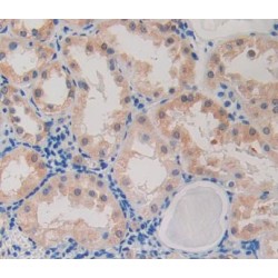 Caspase Recruitment Domain Family, Member 9 (CARD9) Antibody