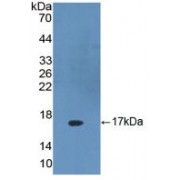 Western blot analysis of recombinant Human DKK4.