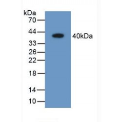 Aldose Reductase Like Protein 1 (ARL1) Antibody