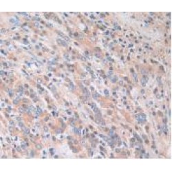 Protein SCAF11 (SCAF11) Antibody
