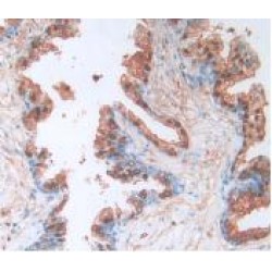 Protein SCAF11 (SCAF11) Antibody