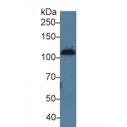 Western blot analysis of Human Serum, using Human C7 Antibody (5 µg/ml) and HRP-conjugated Goat Anti-Rabbit antibody (<a href="https://www.abbexa.com/index.php?route=product/search&amp;search=abx400043" target="_blank">abx400043</a>, 0.2 µg/ml).