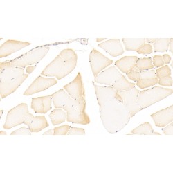 Nitric Oxide Synthase, Inducible (NOS2) Antibody