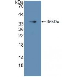 GDP Dissociation Inhibitor 1 (GDI1) Antibody