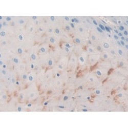 Basal Cell Adhesion Molecule (BCAM) Antibody