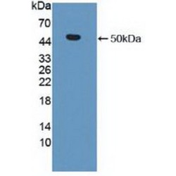 Matrix Metalloproteinase 19 (MMP19) Antibody