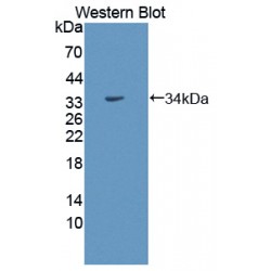 G Protein Coupled Receptor Kinase 4 (GRK4) Antibody