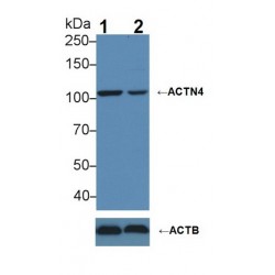 Actinin Alpha 4 (ACTN4) Antibody