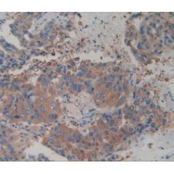 Actinin Alpha 4 (ACTN4) Antibody