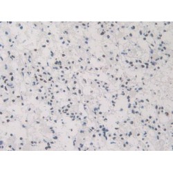 Heterogeneous Nuclear Ribonucleoprotein A1 (HNRPA1) Antibody