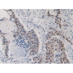 Heterogeneous Nuclear Ribonucleoprotein A1 (HNRPA1) Antibody