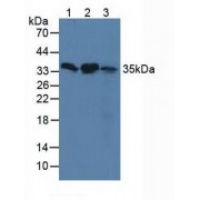 Western blot analysis of (1) Human HeLa cells, (2) Human 293T Cells and (3) Human hepG2 Cells.