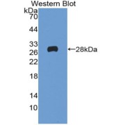 Western blot analysis of the recombinant protein.