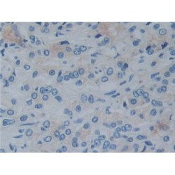 Reelin (RL) Antibody