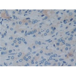 Reelin (RELN) Antibody