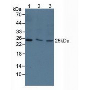 Western blot analysis of (1) Human 293T Cells, (2) Human MCF7 Cells and (3) Human HeLa cells.