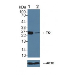 Thymidine Kinase 1, Soluble (TK1) Antibody