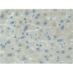 Thymidine Kinase 1, Soluble (TK1) Antibody