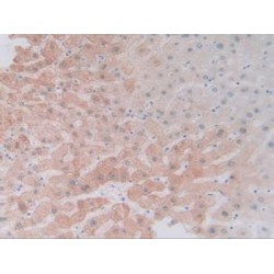 Cytochrome P450 3A4 (CYP3A4) Antibody