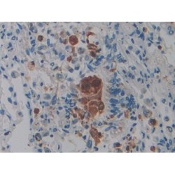 Protein Tyrosine Phosphatase Receptor Type Q (PTPRQ) Antibody