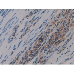 Vasopressin-Neurophysin 2-Copeptin (AVP) Antibody
