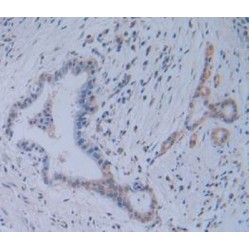Toll Like Receptor Adaptor Molecule 1 (TICAM1) Antibody