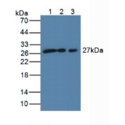 Western blot analysis of (1) Human MCF-7 Cells, (2) Human 293T Cells and (3) Human A431 Cells.