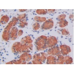 Protein SCO2 Homolog, Mitochondrial (SCO2) Antibody