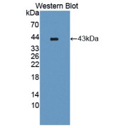 Western blot analysis of the recombinant protein.