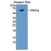 Western blot analysis of recombinant Human TNX.
