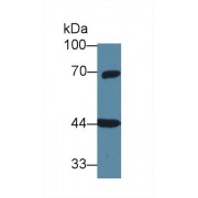 Western blot analysis of Rat Cerebrum lysate, using Human GNa11 Antibody (1 µg/ml) and HRP-conjugated Goat Anti-Rabbit antibody (<a href="https://www.abbexa.com/index.php?route=product/search&amp;search=abx400043" target="_blank">abx400043</a>, 0.2 µg/ml).