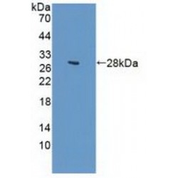 Guanylate Cyclase 1 Beta 3 (GUCY1b3) Antibody