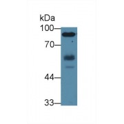 Western blot analysis of Human Jurkat cell lysate, using Human HCK Antibody (2 µg/ml) and HRP-conjugated Goat Anti-Rabbit antibody (<a href="https://www.abbexa.com/index.php?route=product/search&amp;search=abx400043" target="_blank">abx400043</a>, 0.2 µg/ml).