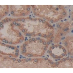 Interleukin 21 Receptor (IL21R) Antibody