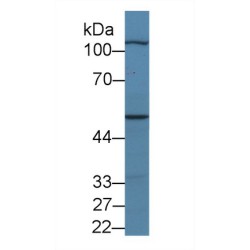 Myopalladin (MYPN) Antibody